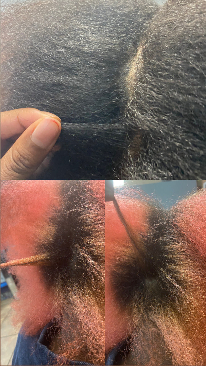 Scalp Soil Really Works